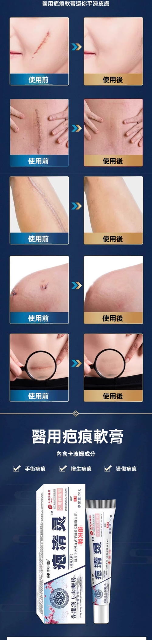 131600158417.png 9a186662a888e2d85d30d8b6cc4d32a7.png